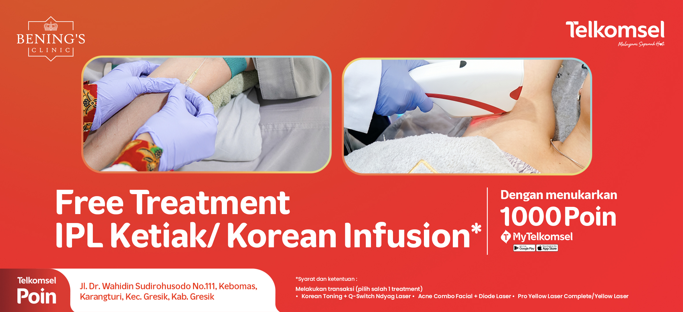 Free Treatment IPL Ketiak/Korean Infusion *SKB